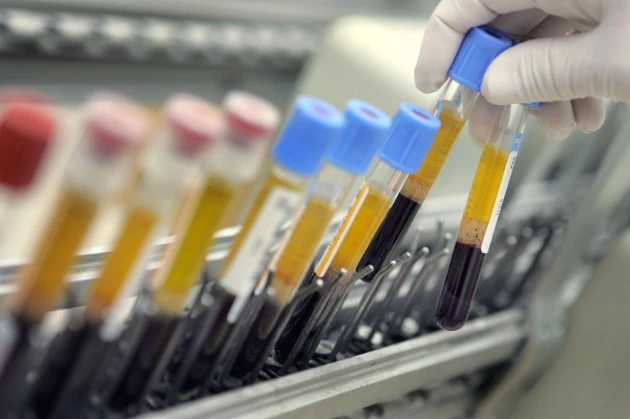 Blood tests Blood tests